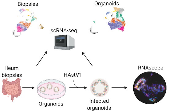 Single-cell transcriptomics reveals immune response of intestinal cell ...